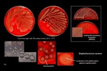 staph aureus